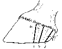 DIAGRAM ILLUSTRATING THE POSITION OF THE GROOVES IN THE WALL IN COLONEL SMITH'S OPERATION FOR SIDE-BONE.