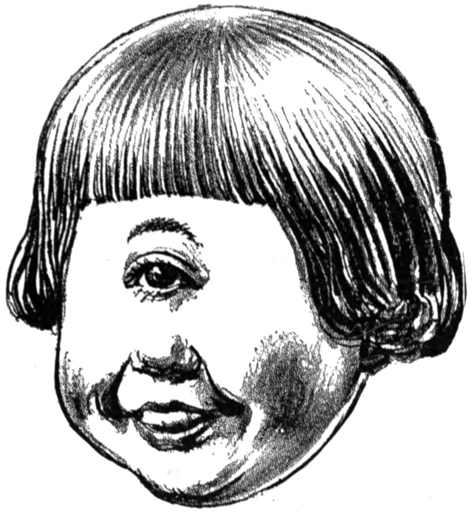 Child with a single eye in its forehead