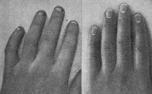 Nails