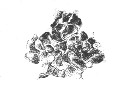 Illustration: Fig. 31.&mdash;Part of the
zoarium of Victorella bengalensis entirely transformed into resting
buds, � 25. (From an aquarium in Calcutta.)