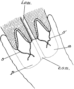 Marckwald&rsquo;s Operation for
Congenital Hypertrophy of the Cervix