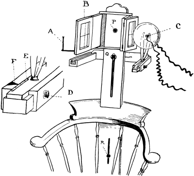 Author&rsquo;s Chair for the Localization of Foreign Bodies in The Eye