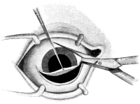 Mules&rsquo;s Operation